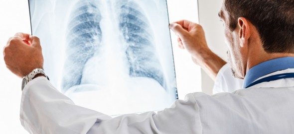 Doctor examining a radiography