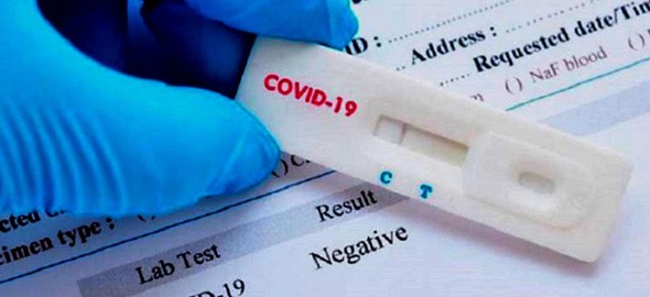 nov_2020_raccomandazione-ue-covid-19-test-antigenico